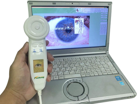 maikong USB iridology Camera for pc with Spanish and English Software